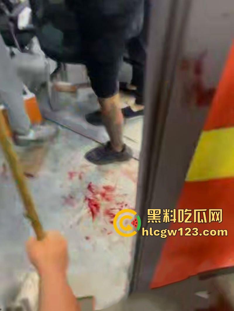 精神小伙台球厅打斗事件!暴怒持刀砍人 手掌惨遭斩成两半 现场血淋淋一片 场面极其血腥胆小勿入!