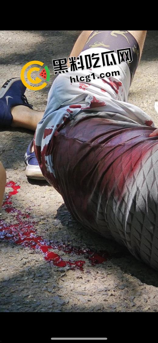 吉林四名外国教师公园参观被刺杀 凶手仍流落在外 现场血腥视频流出