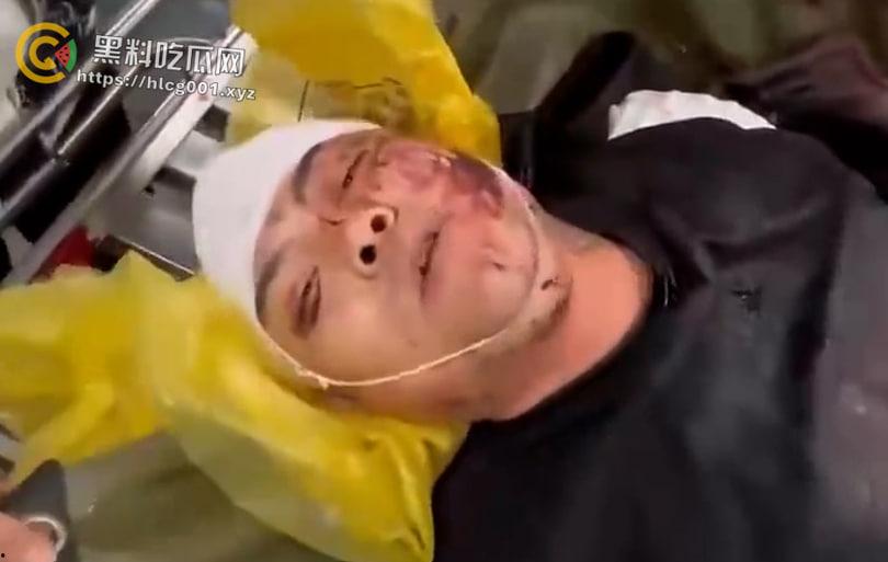 精神小伙战斗合集来了 国产小年轻群殴堪比古惑仔 现在的年轻人动起手真是不知道轻重