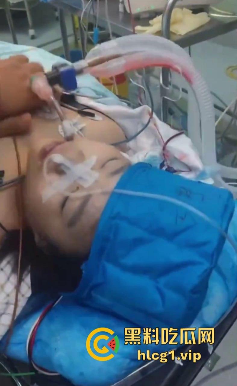 活阎王!哈尔滨市10岁小女孩微创手术身亡 器官被单独摘走!