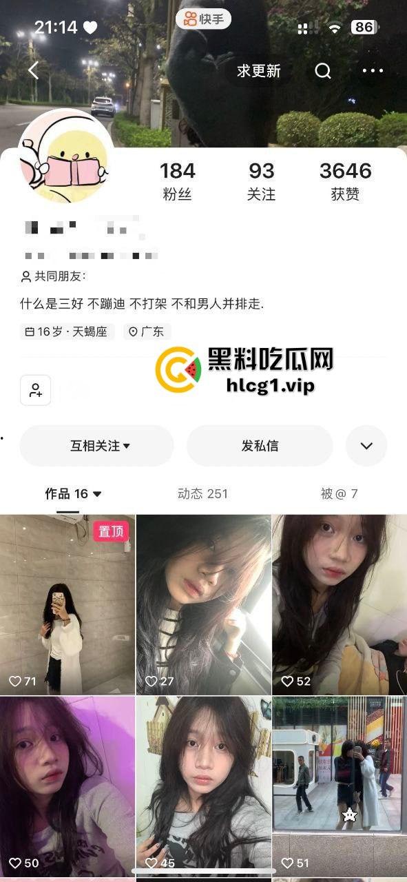 瓜友真实投稿血的教训，以为约炮买一送一！一包烟换来双份激情，却惨遭生化母体感染HPV！