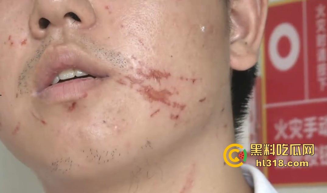 小哥网上想约炮台球助教,想摸人家的丝袜美腿,不料线下被坑5000多,还给打了一顿,真是陪了夫人又折兵!