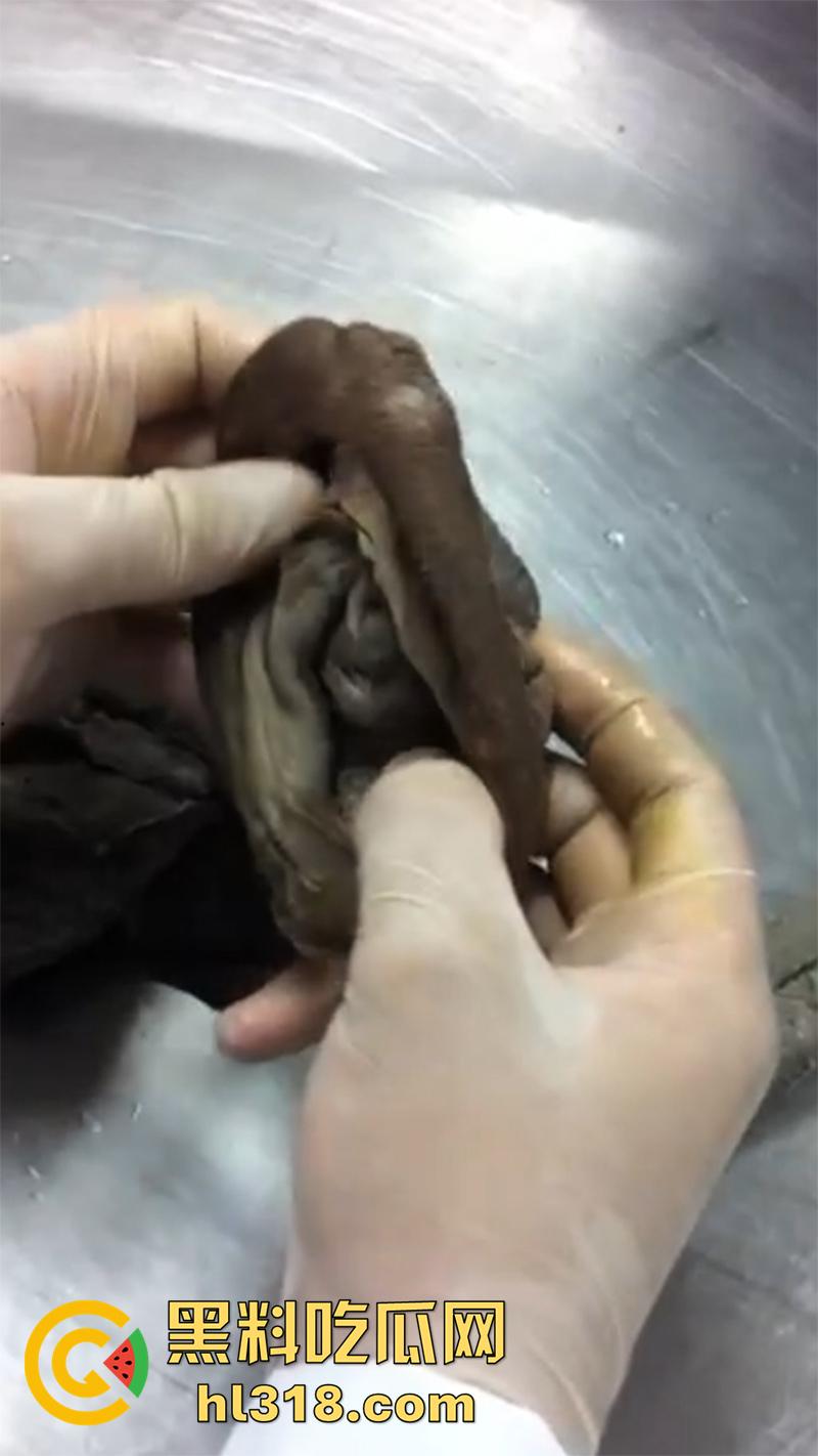 真实西藏密宗法器“肉莲花”,少女被108罗汉轮奸后,五毒侵蚀九蒸九炼,活体切割才可肉莲大成!