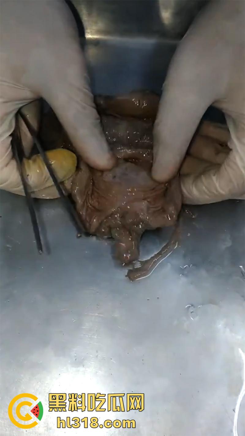 真实西藏密宗法器“肉莲花”,少女被108罗汉轮奸后,五毒侵蚀九蒸九炼,活体切割才可肉莲大成!