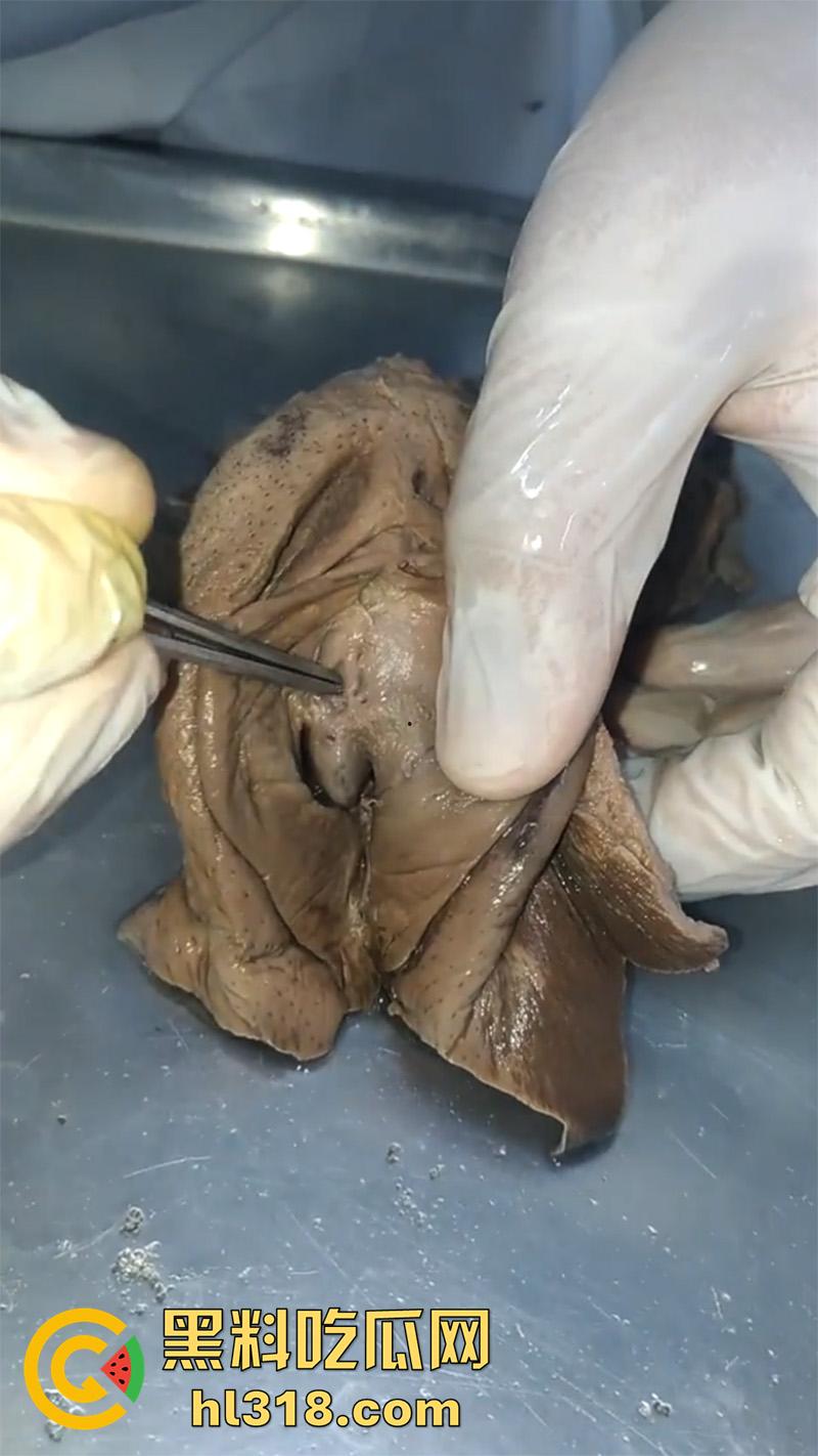 真实西藏密宗法器“肉莲花”,少女被108罗汉轮奸后,五毒侵蚀九蒸九炼,活体切割才可肉莲大成!