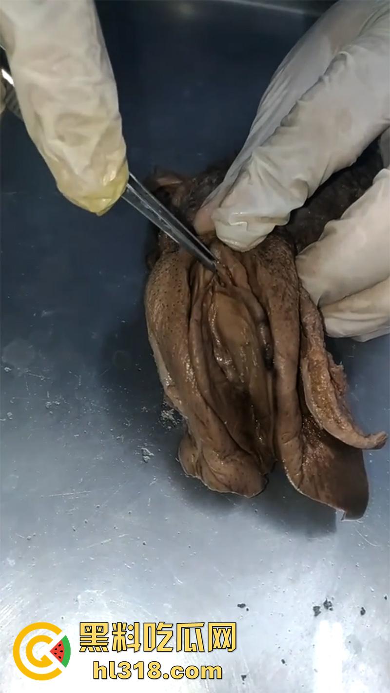 真实西藏密宗法器“肉莲花”,少女被108罗汉轮奸后,五毒侵蚀九蒸九炼,活体切割才可肉莲大成!