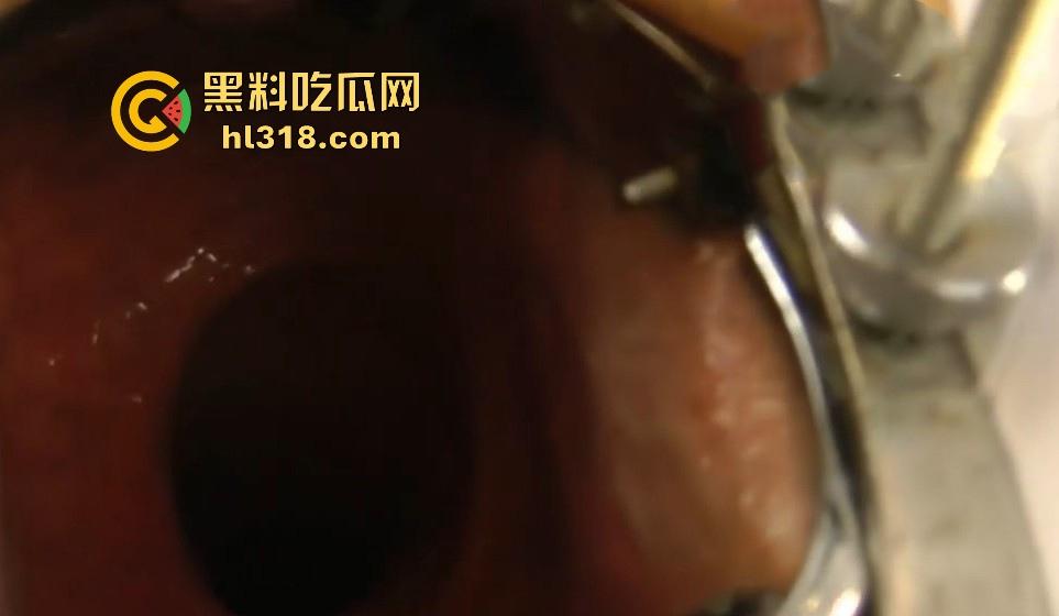 重口慎入!欧美骚妇变态扩肛,超大号道具捅菊花直至小腹隆起,直肠深处清晰呈现,这可真是一步到胃啊!