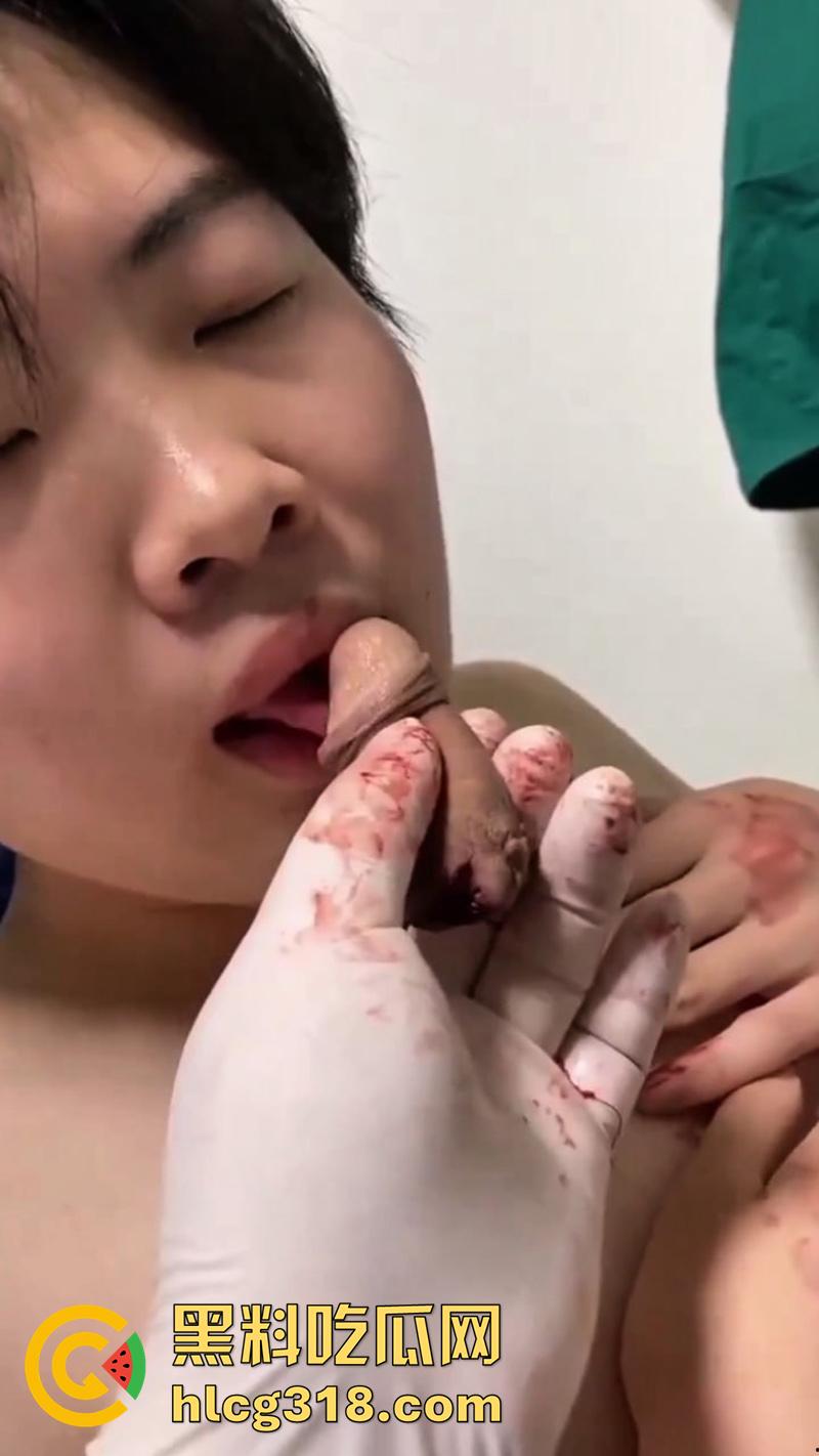 广西猛男刀切小鸡鸡,00后小火竟自己动手割下鸡巴,还给女友口交玩弄,现在都玩这么变态了么!