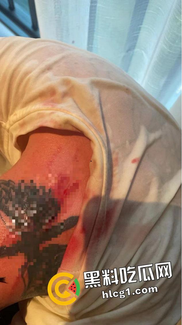 全网丢人的精神小伙【陈浩轩】背着女友偷吃被抓!被女友打的头破血流 现场视频流出