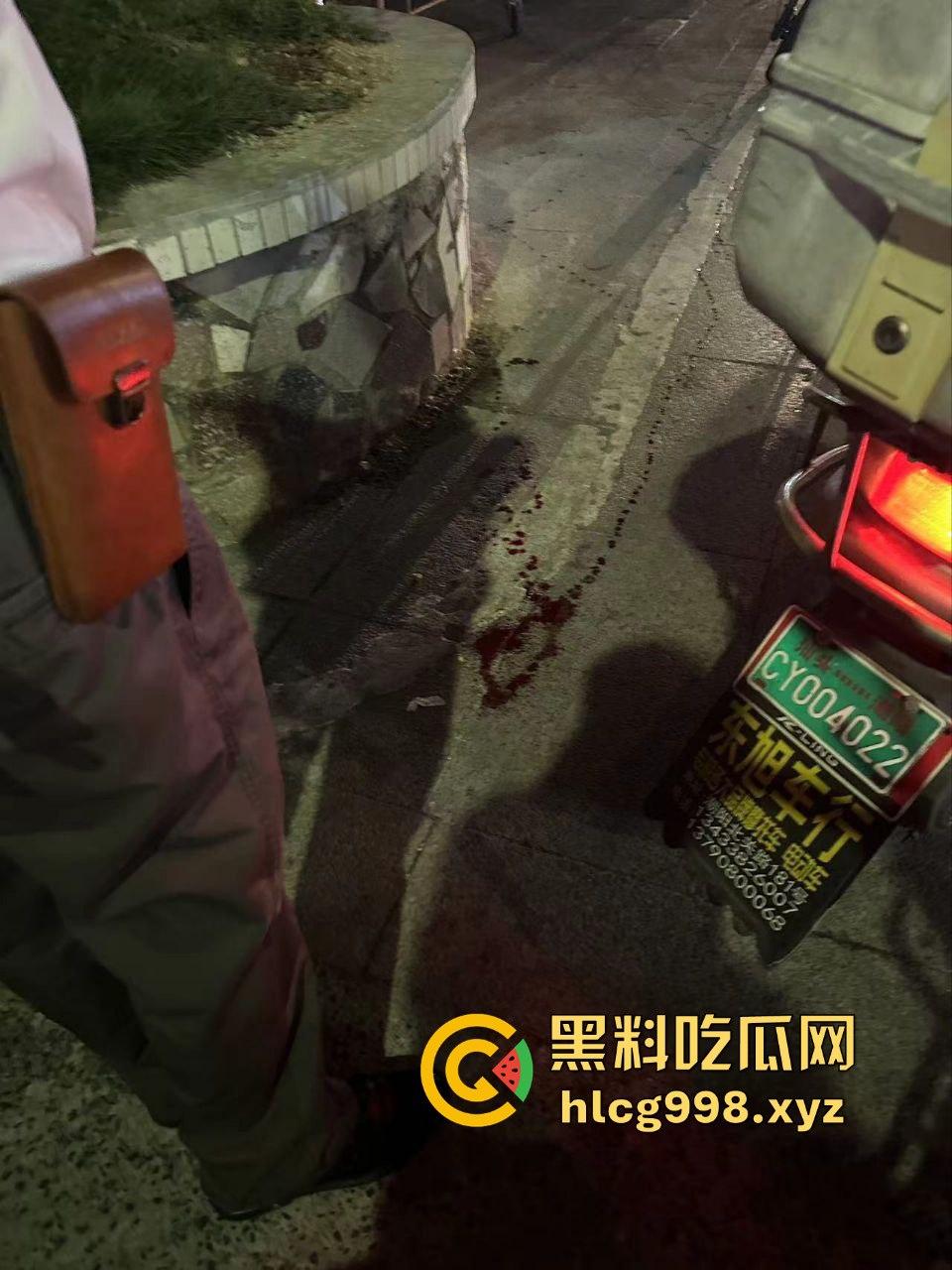 潮阳棉城精神小伙街头斗殴!马刀上手,砍到手臂当场飞掉!