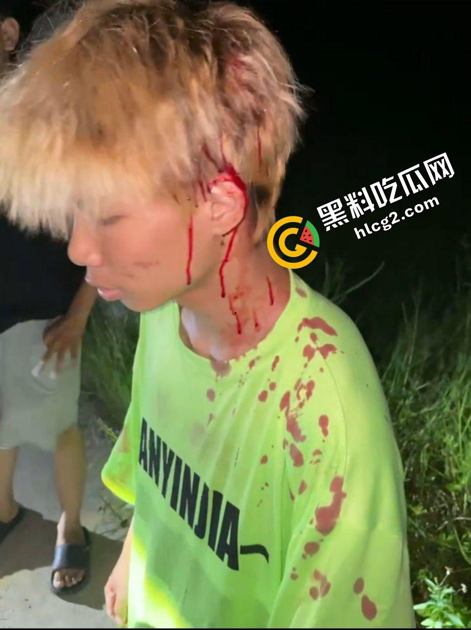 广西南宁精神小伙打架斗殴 铁棍抽打黄毛头 狂砸小毛驴 头破血流后仓皇逃走