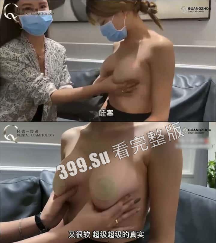 医美整形那些事儿 假的真不了 看的脸皮发麻 (三)