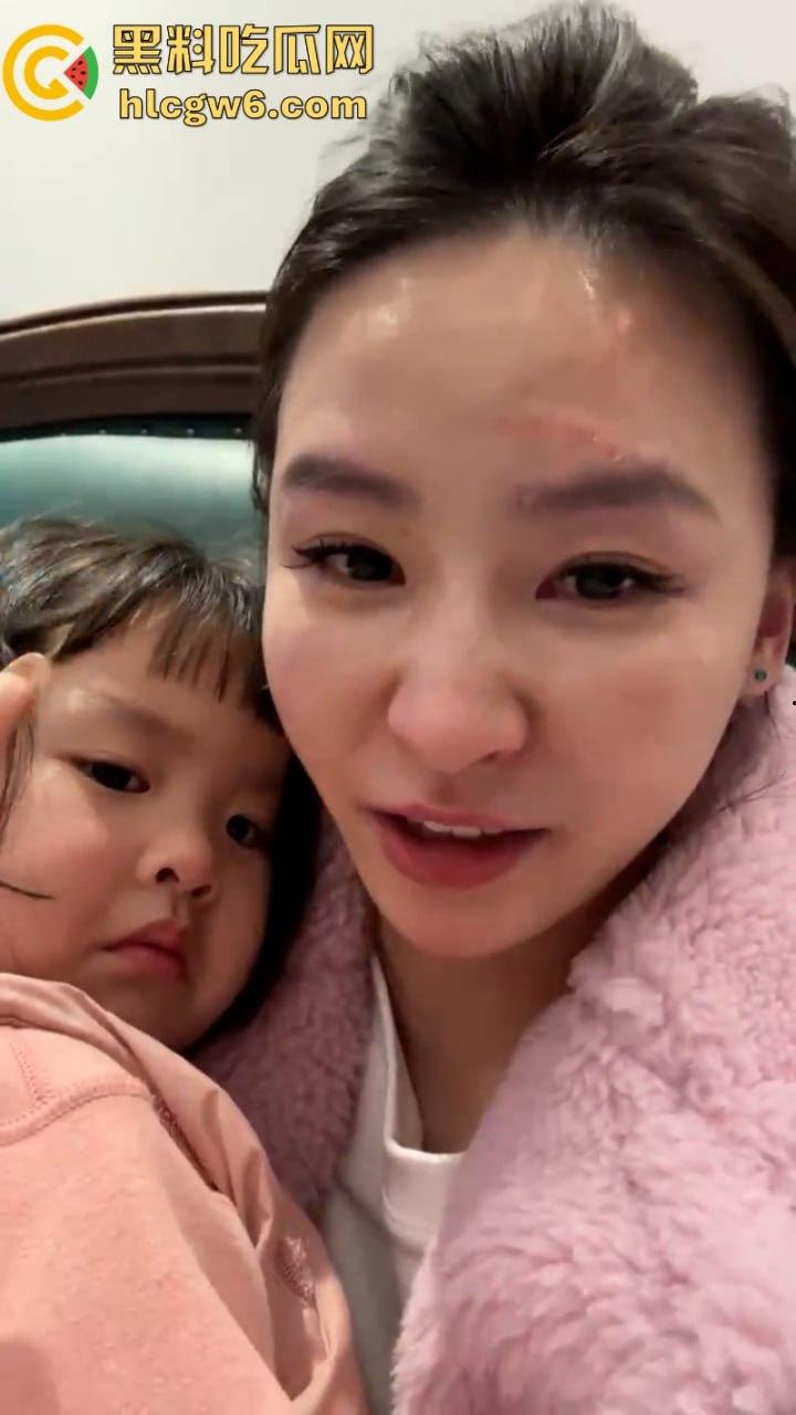 湖北一小学美女老师抖音自曝离婚探女遭前夫爹殴打抓脸全身多处受伤 伤情实拍曝光!都是血口子