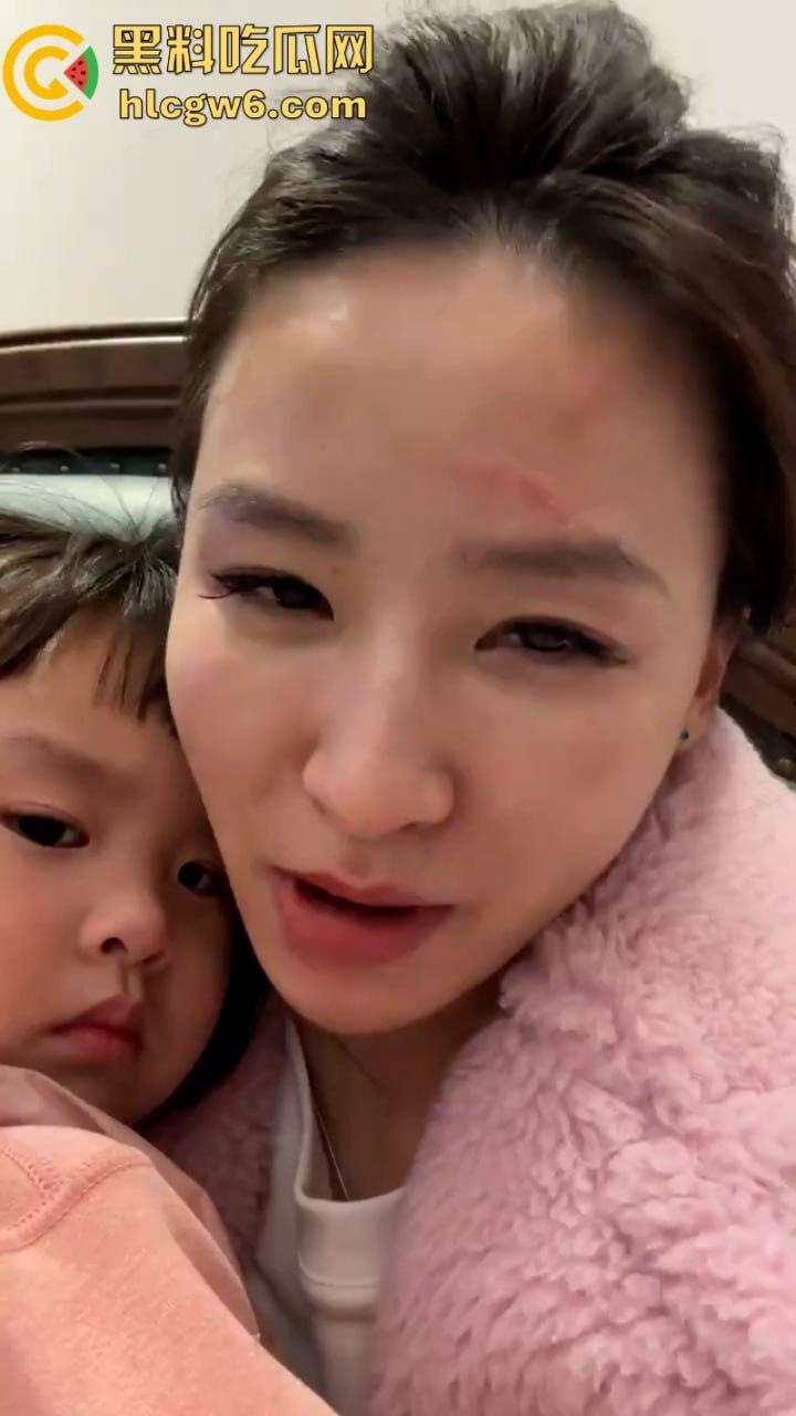 湖北一小学美女老师抖音自曝离婚探女遭前夫爹殴打抓脸全身多处受伤 伤情实拍曝光!都是血口子