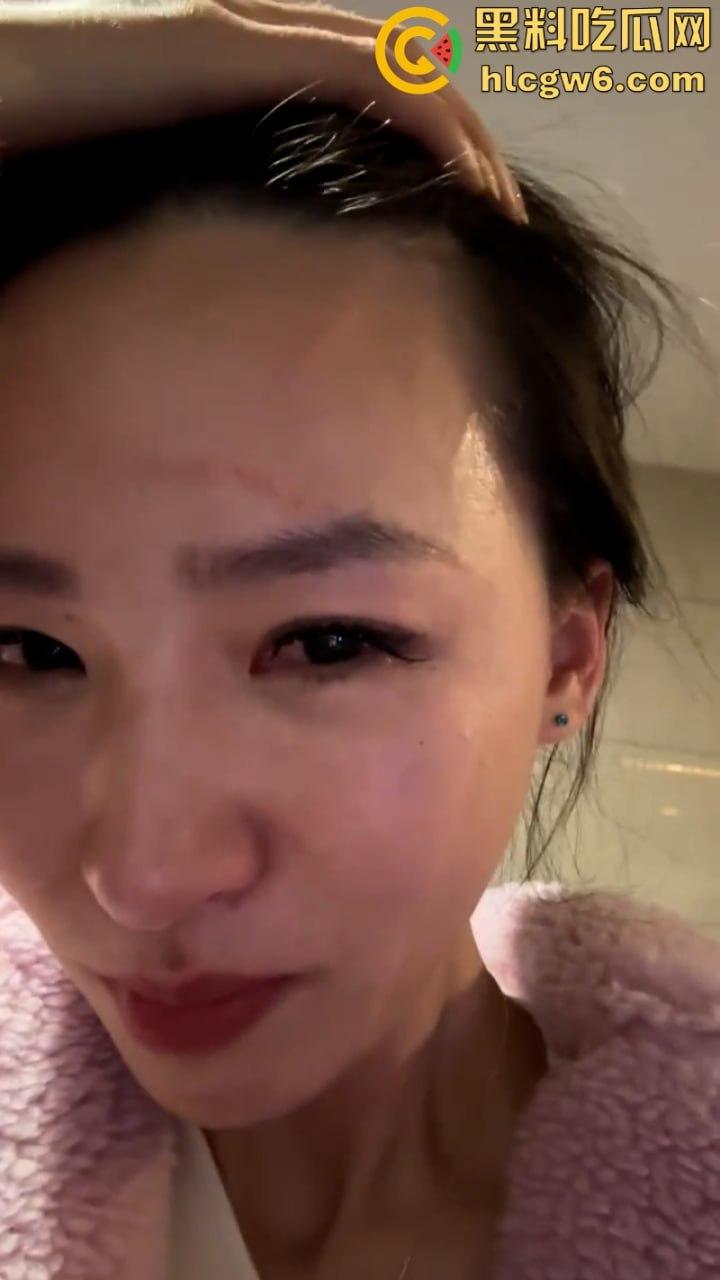 湖北一小学美女老师抖音自曝离婚探女遭前夫爹殴打抓脸全身多处受伤 伤情实拍曝光!都是血口子