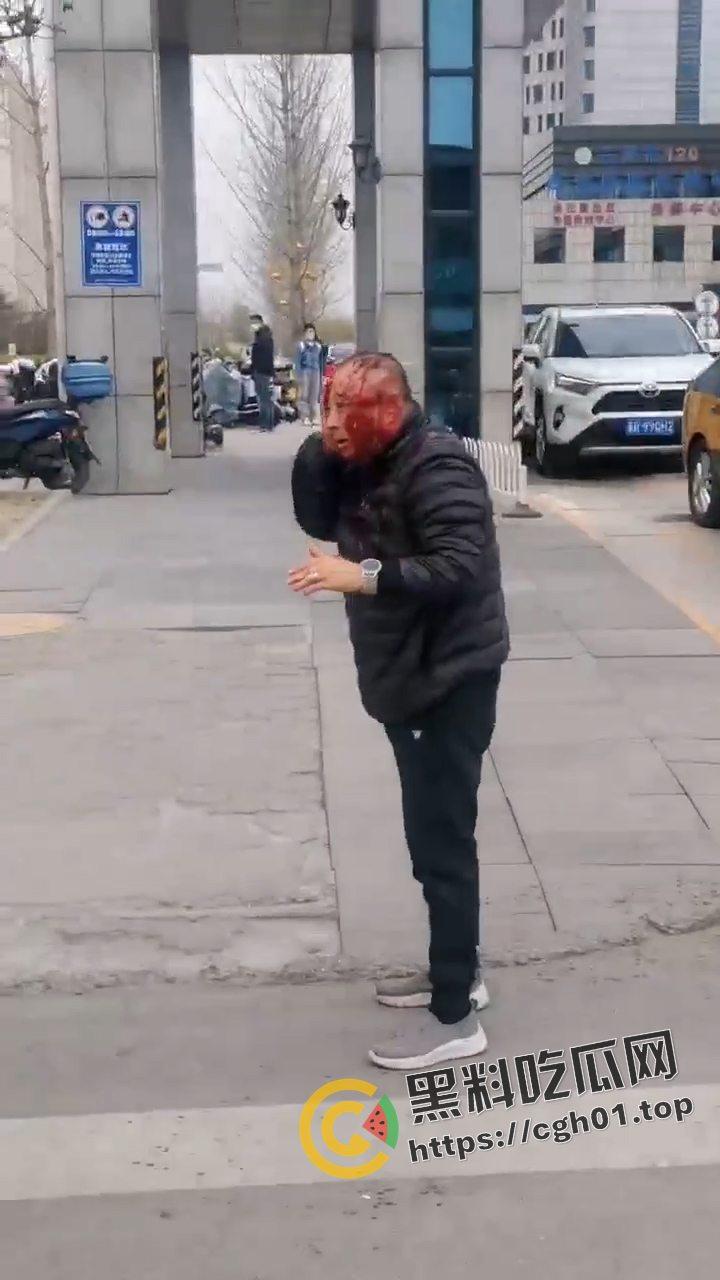 河北燕郊滴滴大战出租车!因为15元得单子出租车司机拿螺丝刀把滴滴司机脑袋捅烂 现场血腥画面流出