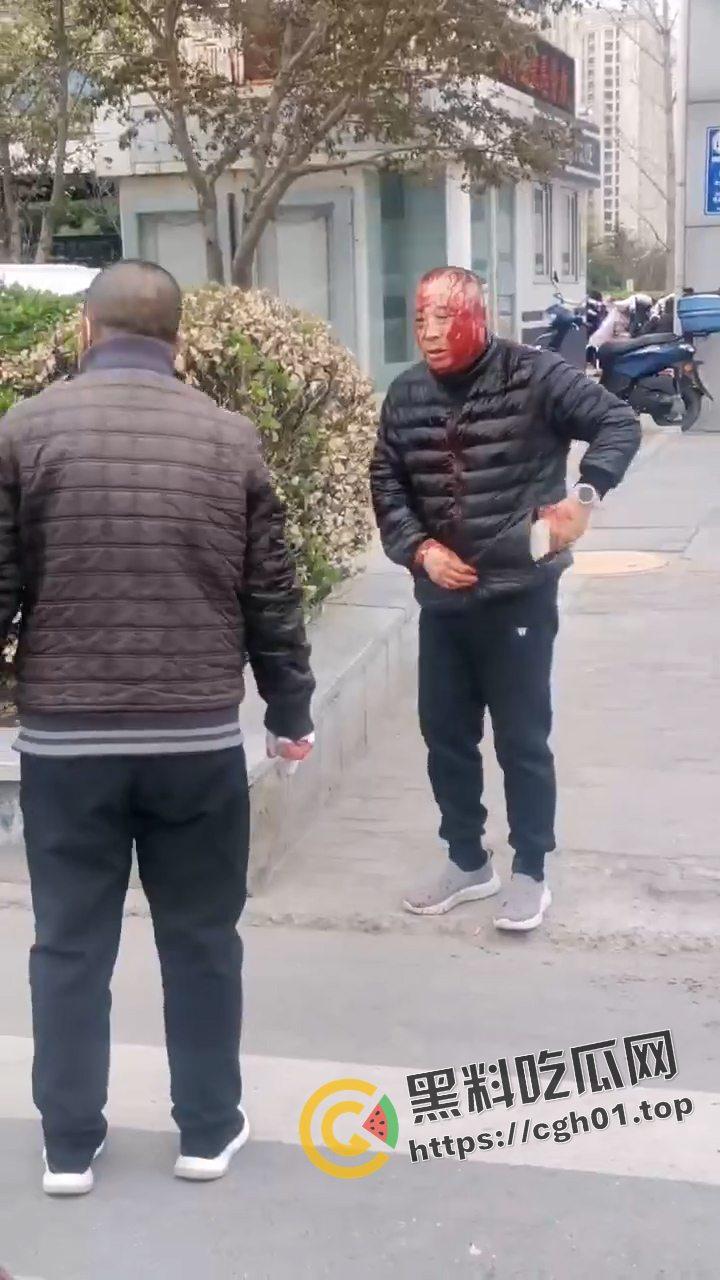 河北燕郊滴滴大战出租车!因为15元得单子出租车司机拿螺丝刀把滴滴司机脑袋捅烂 现场血腥画面流出