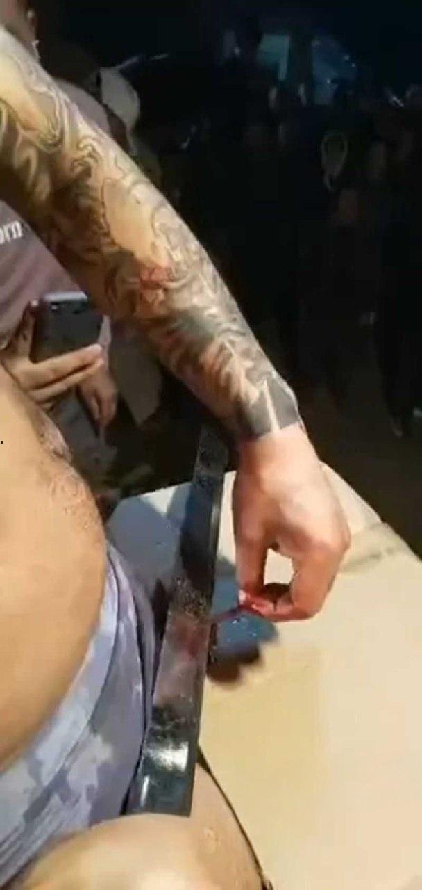 猎奇的重口慎入!男子当街表演,男子拿着砍刀割包皮,满桌子都是血,是因为不想让医院挣那么多钱吗 ?