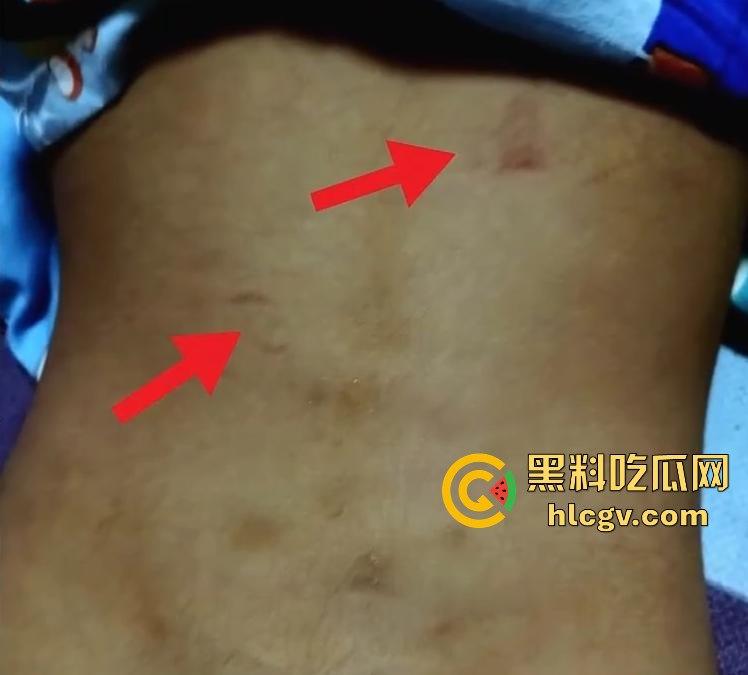 长沙幼儿园虐童!孩子被两名老师拖地打,家长怒发视频控诉!