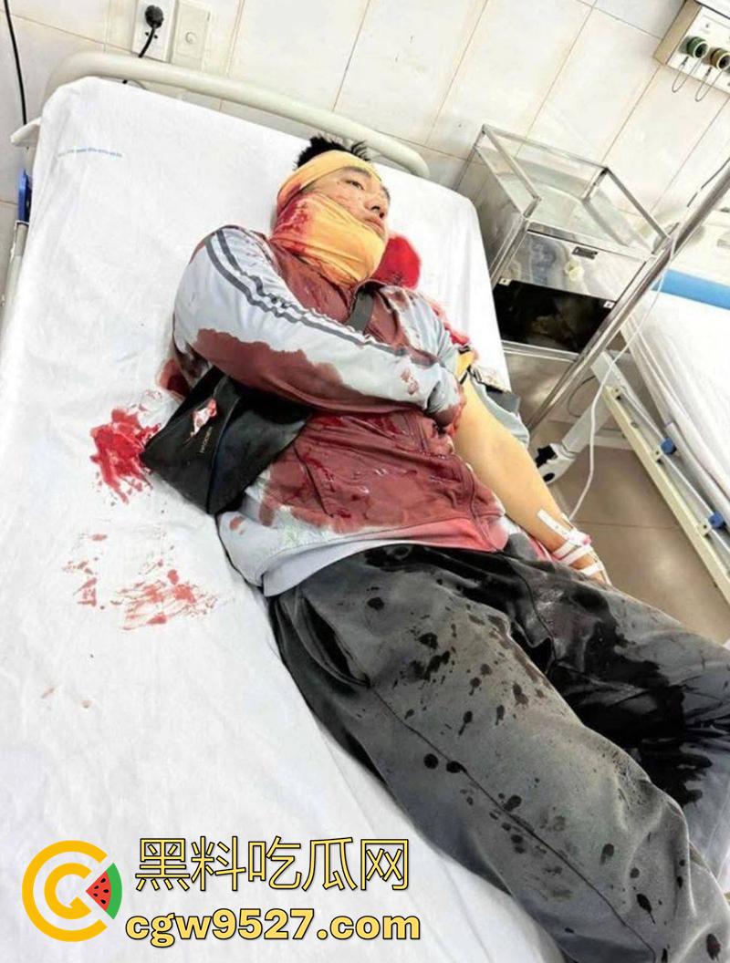 越南海防水果批发市场,发生重大砍人事件,男子手持菜刀疯狂劈砍,导致三人身受重伤,现场视频流出!