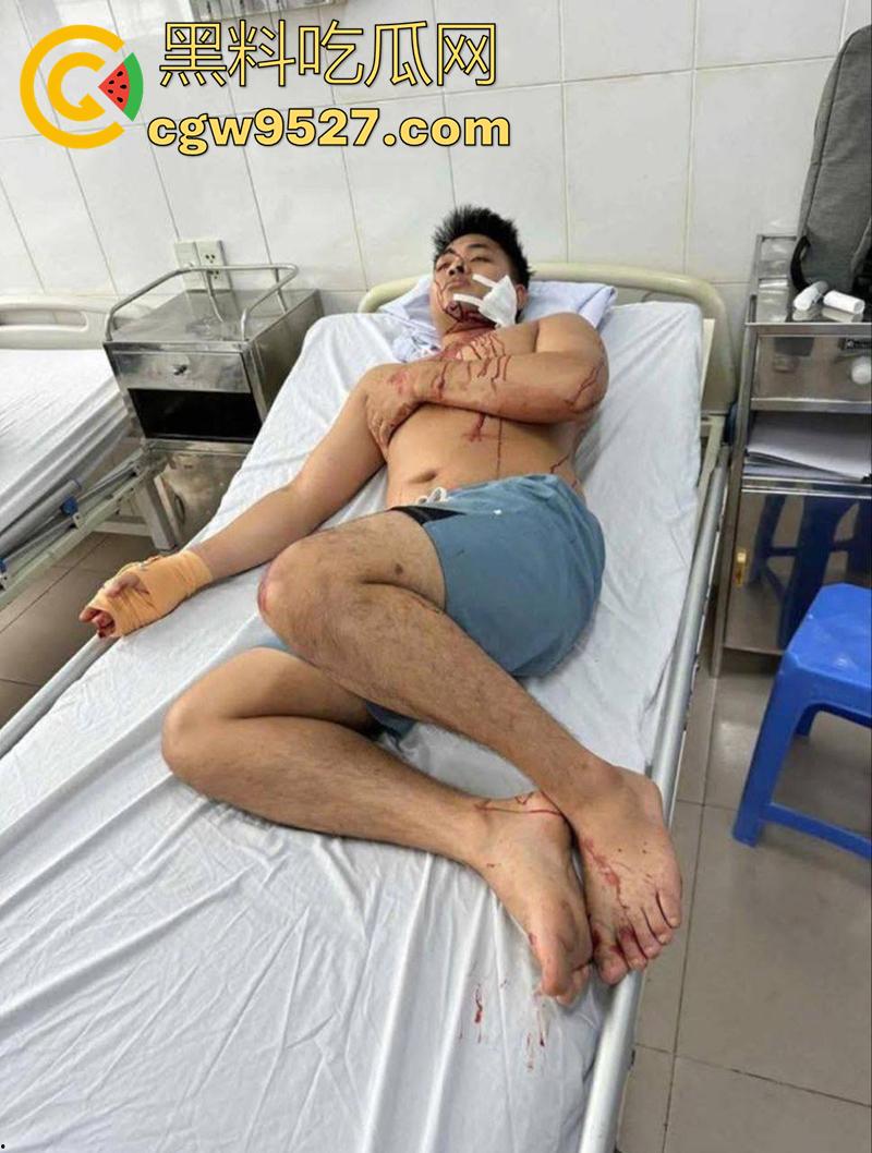 越南海防水果批发市场,发生重大砍人事件,男子手持菜刀疯狂劈砍,导致三人身受重伤,现场视频流出!