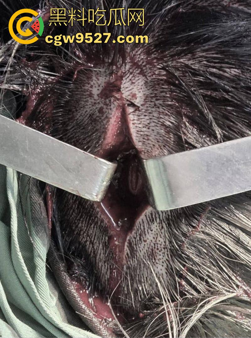 越南海防水果批发市场,发生重大砍人事件,男子手持菜刀疯狂劈砍,导致三人身受重伤,现场视频流出!