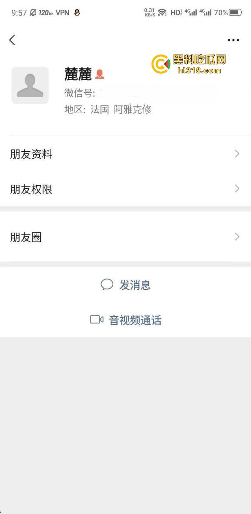极品巨乳学生妹【林麓】网调视频曝光,背男友拍露脸自慰视频约炮金主,湿漉嫩逼与巨乳一览无余!
