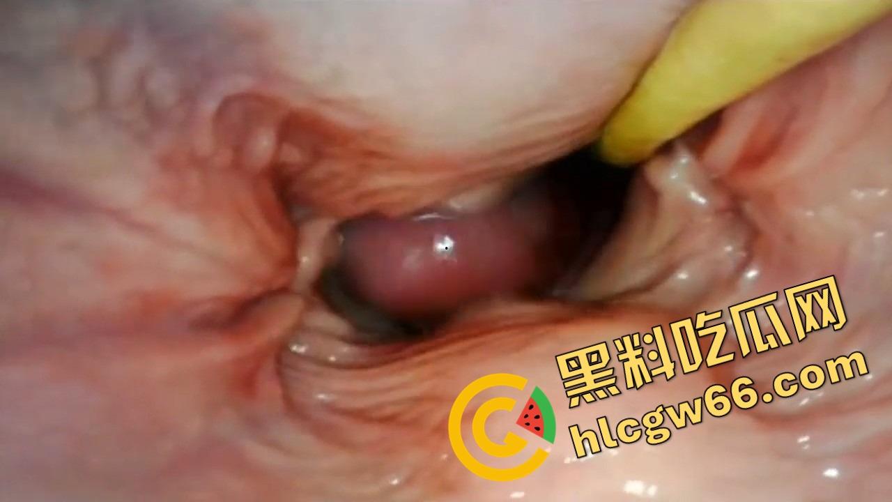 欧美巨屌狂插内窥视角爆火阴道深处褶皱翻卷、肉壁收缩蠕动,全程高清记录快感源头!