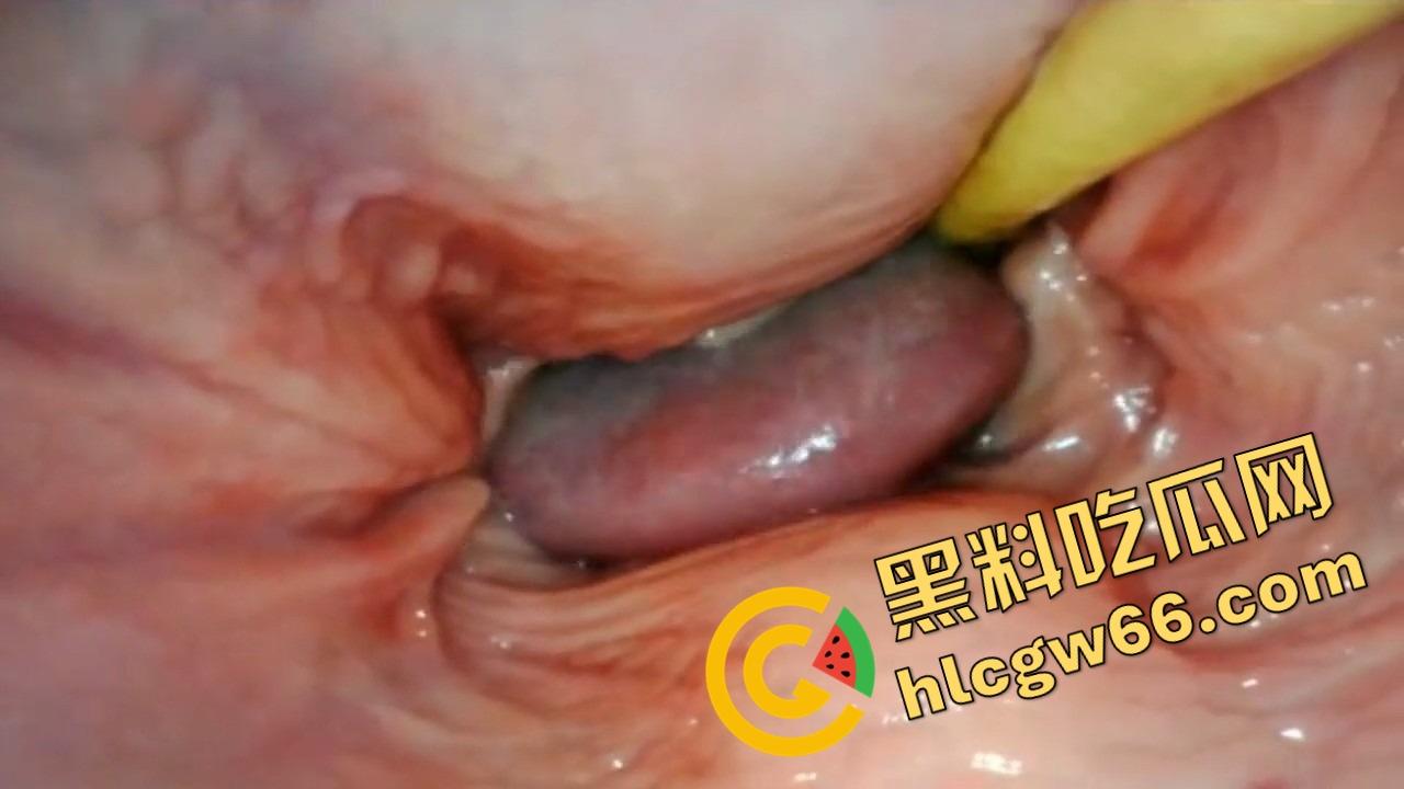 欧美巨屌狂插内窥视角爆火阴道深处褶皱翻卷、肉壁收缩蠕动,全程高清记录快感源头!