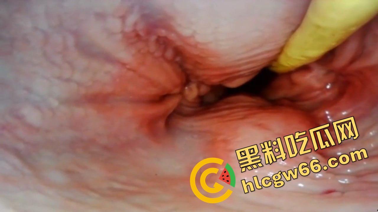 欧美巨屌狂插内窥视角爆火阴道深处褶皱翻卷、肉壁收缩蠕动,全程高清记录快感源头!