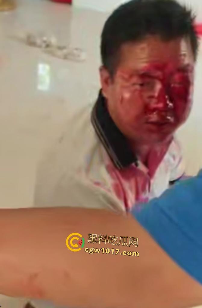 游戏团战关键时刻被老爸关电脑,网瘾儿子阿强直接打亲爸头破血流,老爸跪地求饶“我错了”,老妈哭求和解!