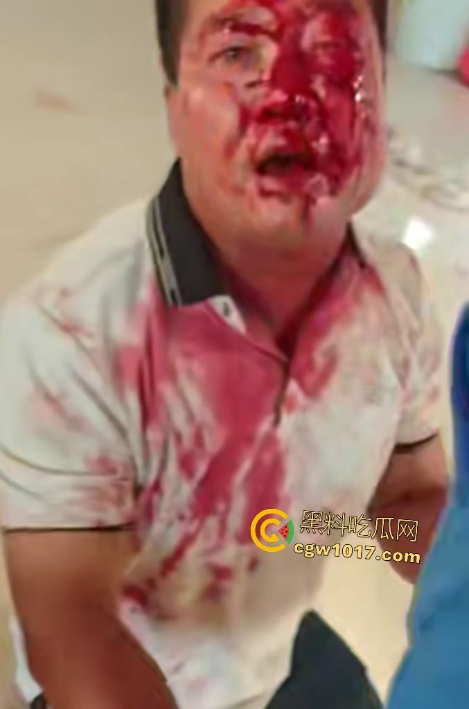 游戏团战关键时刻被老爸关电脑,网瘾儿子阿强直接打亲爸头破血流,老爸跪地求饶“我错了”,老妈哭求和解!