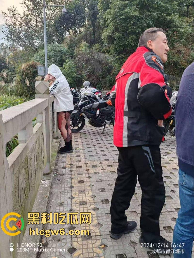 美图秀秀弱爆了 这才是真实磨皮!胖妹装逼压弯失控撞车 黑丝当场爆裂惨遭磨皮 大腿血肉模糊 真是悲惨又丢人!