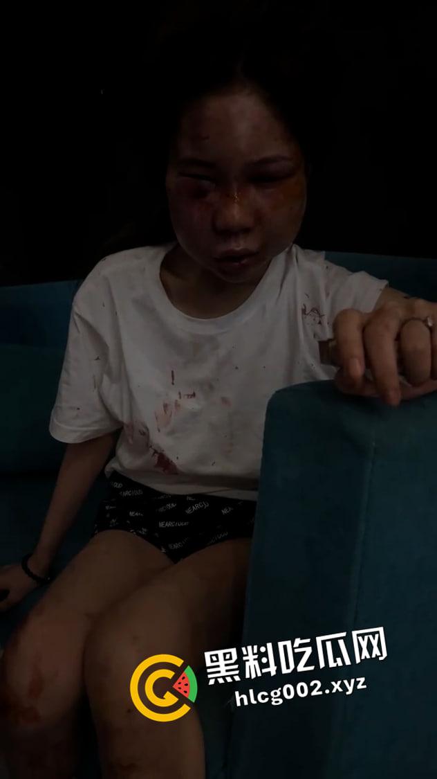 【谭竹】终被制裁打成猪头!外网悬赏金额已达六百万 现场视频流出