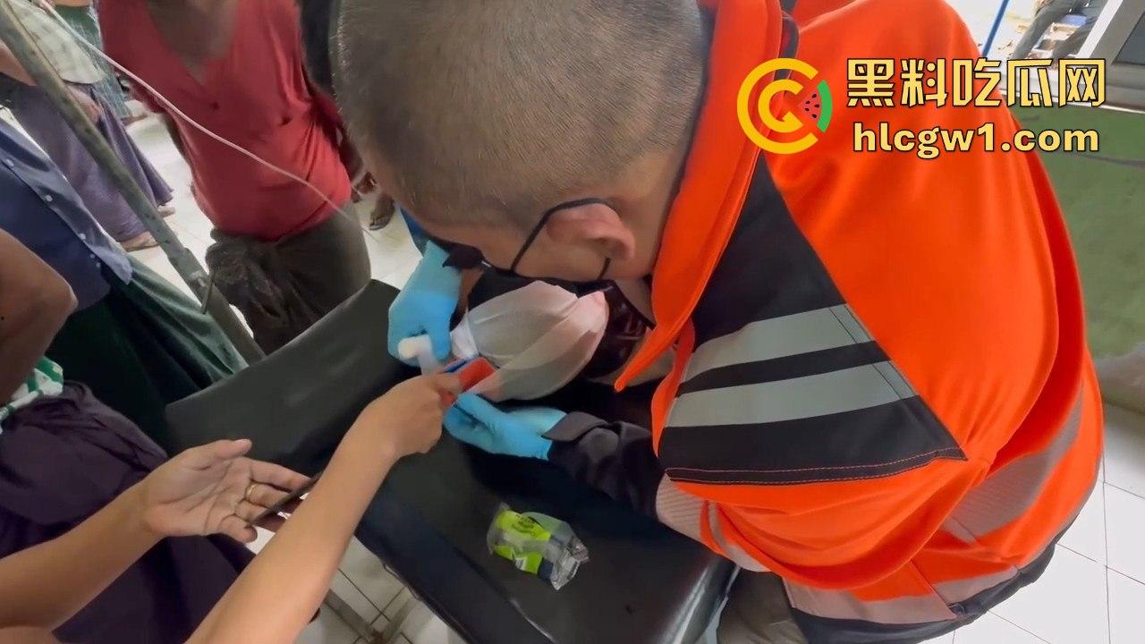 妙瓦底一女孩头部被刀插入!竹片墙掉刀酿惨剧,紧急送往泰国湄索医院!