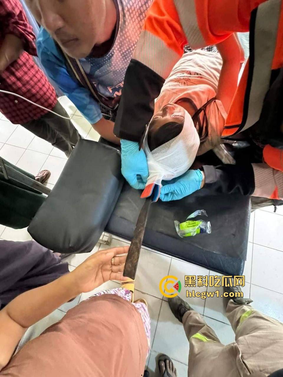 妙瓦底一女孩头部被刀插入!竹片墙掉刀酿惨剧,紧急送往泰国湄索医院!