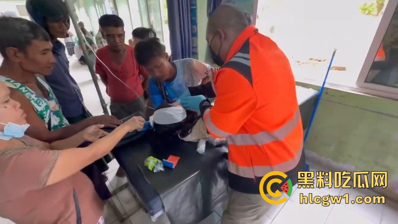 妙瓦底一女孩头部被刀插入!竹片墙掉刀酿惨剧,紧急送往泰国湄索医院!