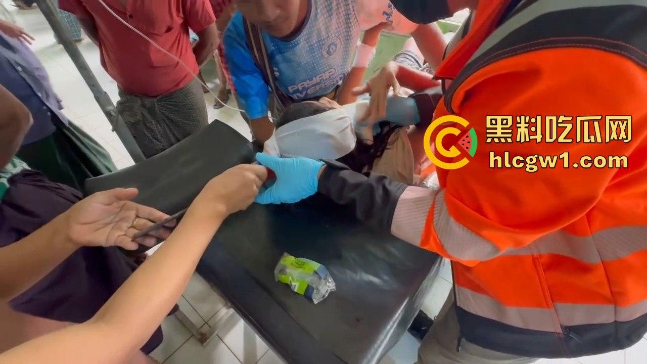 妙瓦底一女孩头部被刀插入!竹片墙掉刀酿惨剧,紧急送往泰国湄索医院!