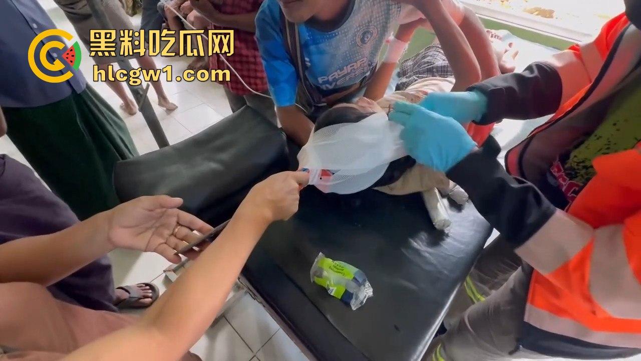 妙瓦底一女孩头部被刀插入!竹片墙掉刀酿惨剧,紧急送往泰国湄索医院!