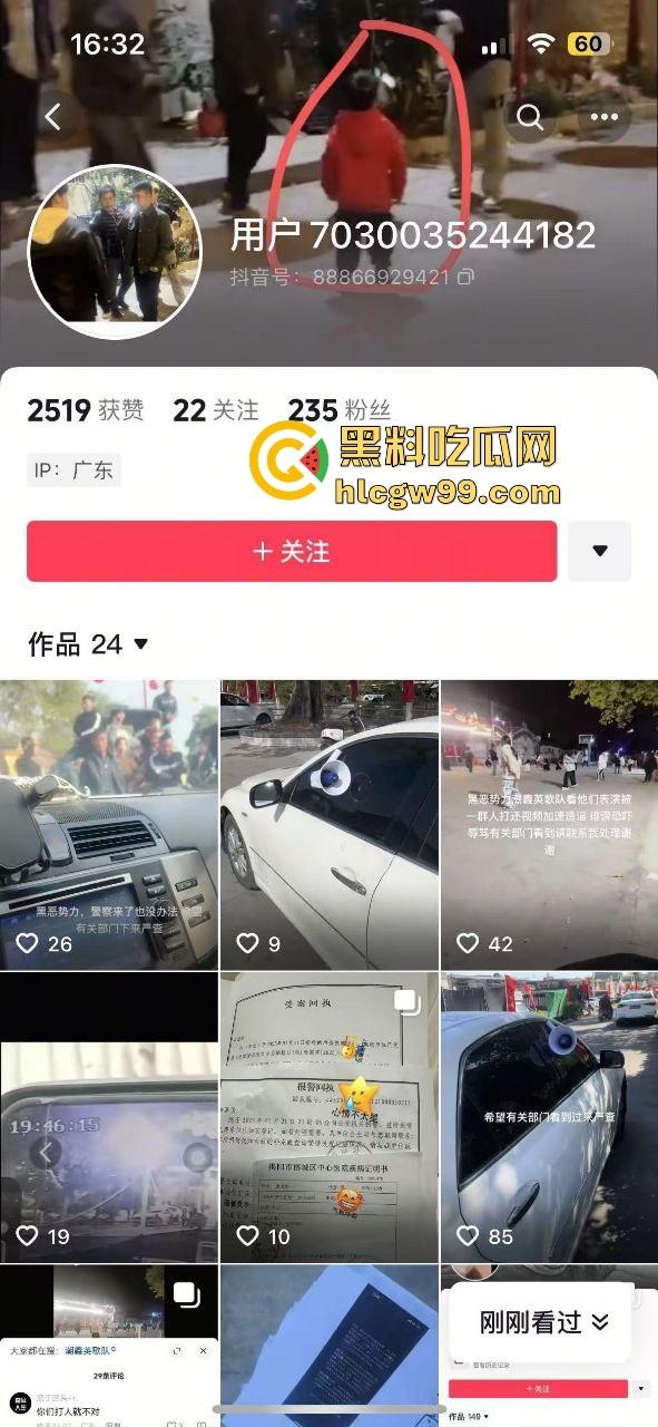 潮汕男子飙车狂言车300万撞死人保险赔，结果被英歌队打到脑震荡，现在出院嚷嚷黑势力又被围了！